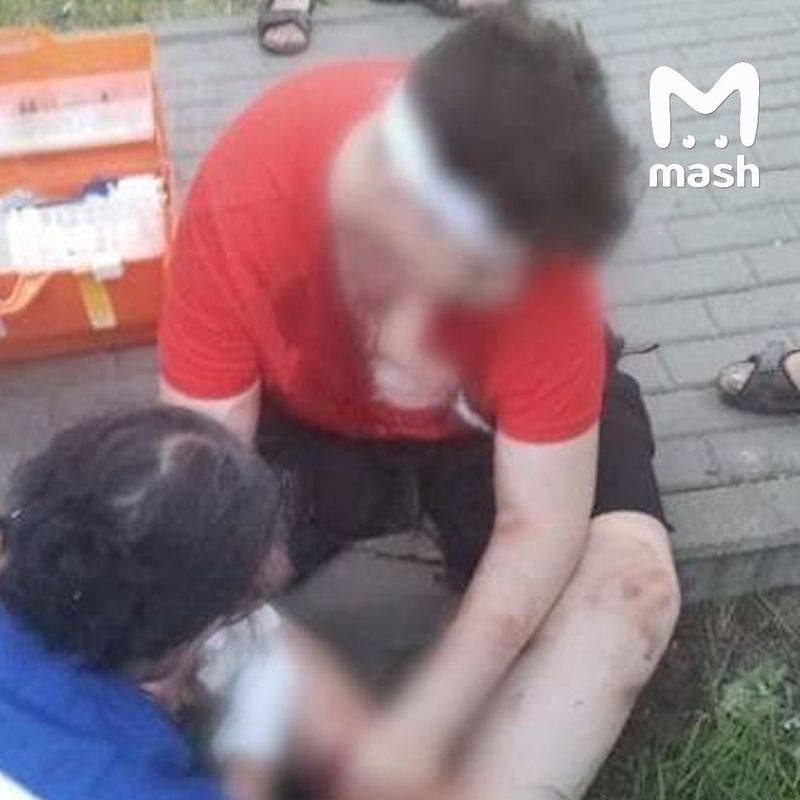 Взорвавшаяся у подмосковного школьника электронная сигарета могла быть миной-ловушкой