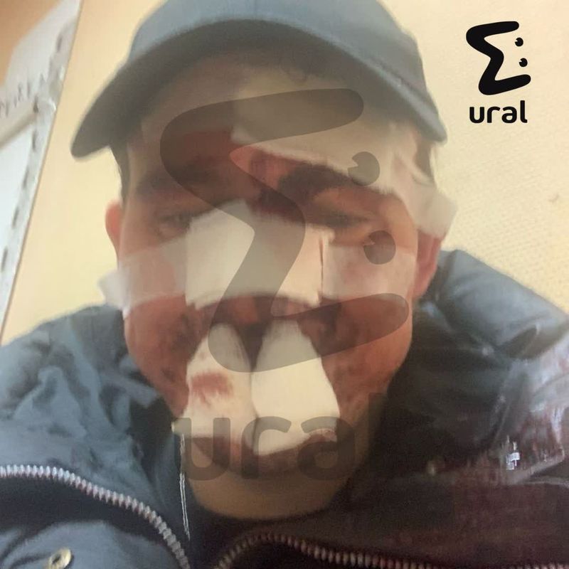 В ночном клубе Челябинска избили скрипача