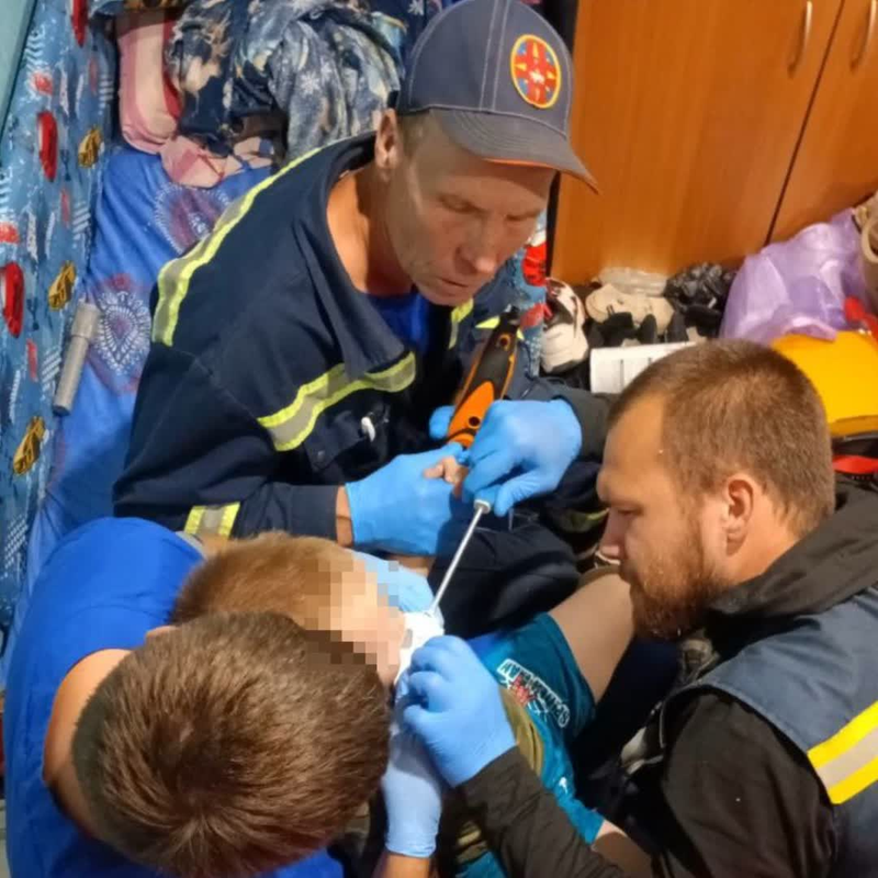 В Перми мальчик засунул язык в машинку для стрижки ногтей и застрял