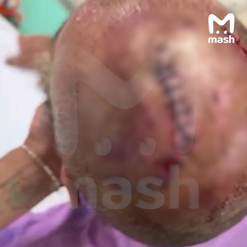 Туристу из России пробили голову мачете в Таиланде