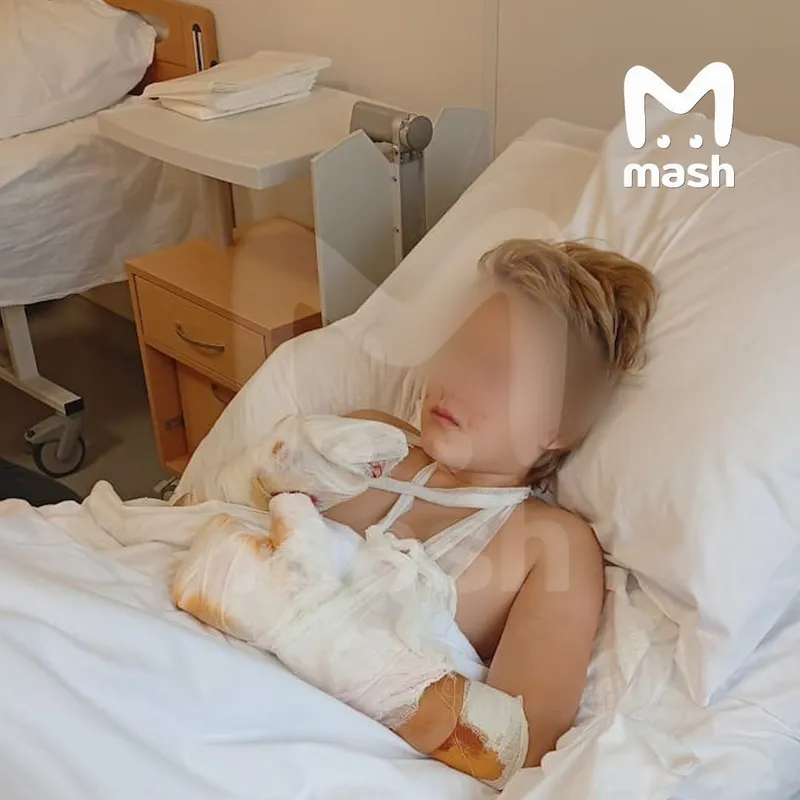 В Красногорске мальчику оторвало пальцы при взрыве: что произошло, фото, видео с места